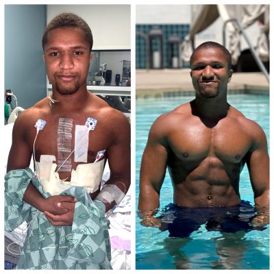 M/23/5’6” Saw The Left Picture On My Google Photos And Was Feeling Proud Of Myself :). 1.5 Years Post Heart-surgery