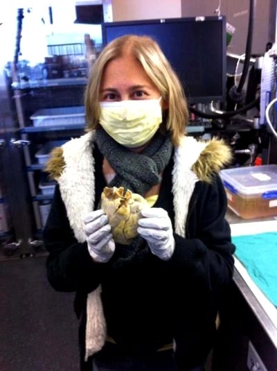 Penny Smith Holds Ber Previous Heart After A Successful Heart Transplant
