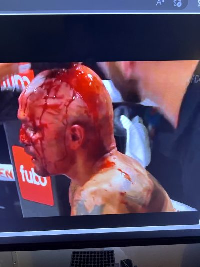 This Guy On BKFC About To Die