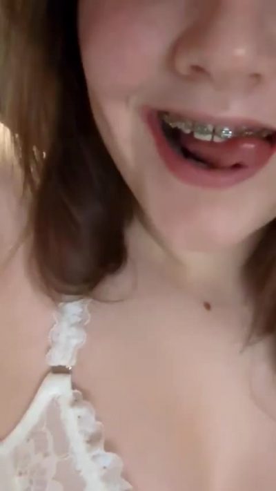 Would You Go For A Bracefaced 18 Y/o College Girl ?