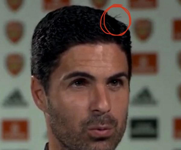 absolute-chaos-as-arsenal-boss-mikel-arteta-has-a-hair-out-of-place-in-latest-interview-ahead-of-west-brom-redcircle-whitecircle_001